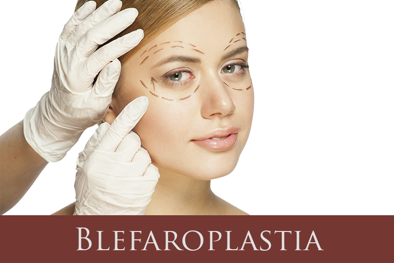 Blefaroplastia