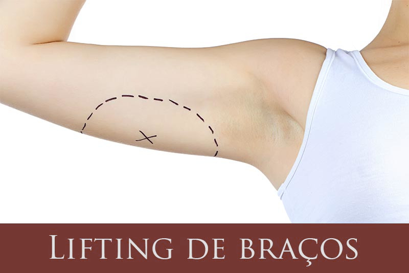 Lifting de braços